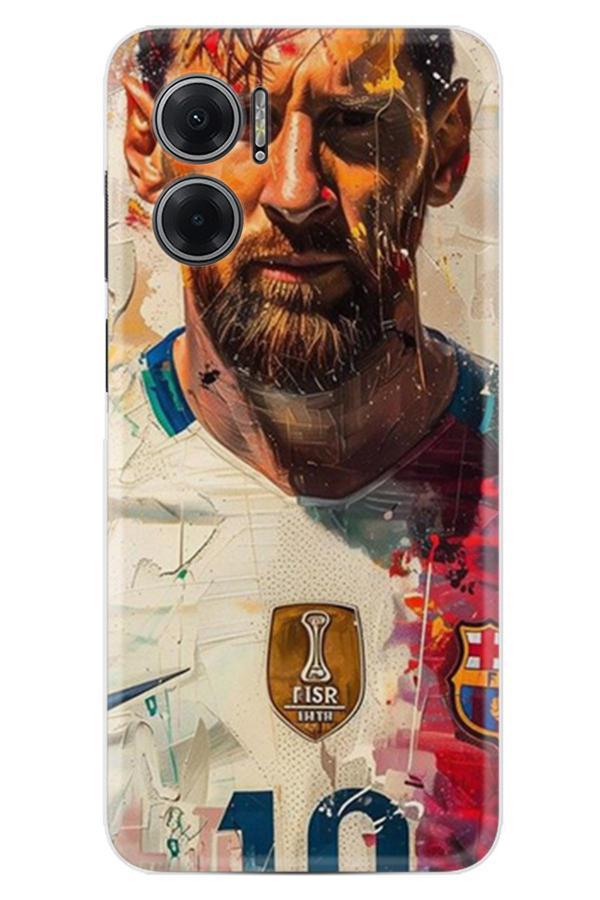 Arvencase Xiaomi Redmi Note 11E Kılıf Özel Seri Baskılı Desenli Yüksek Korumalı Xt-814.Jpg - Image 1