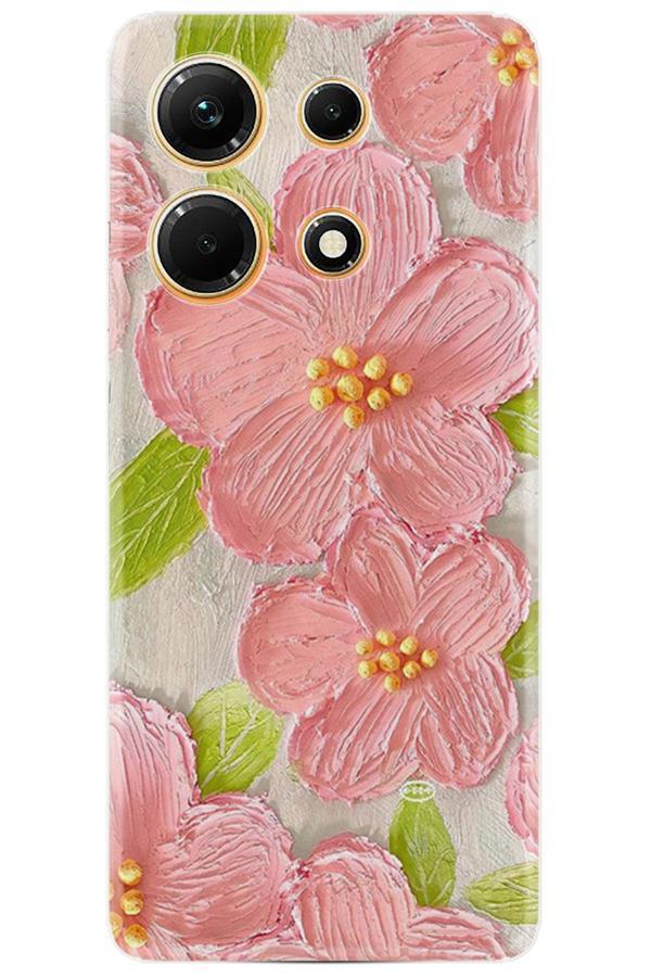 Arvencase İnfinix Note 30 Kılıf Hd Baskılı Kılıf Yüksek Korumalı - Name-21-Note30 - Image 1