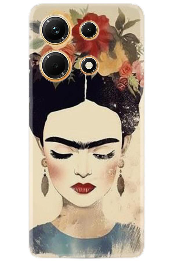 Arvencase İnfinix Note 30 Kılıf Hd Baskılı Kılıf Yüksek Korumalı - Name-41-Note30 - Image 1