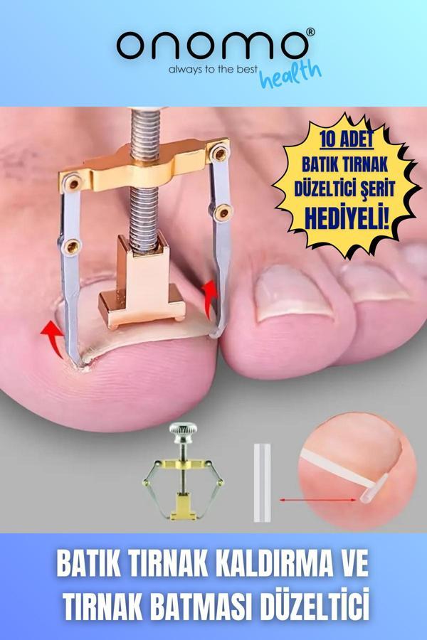 Onomo Health Batık Tırnak Düzeltici Batık Tırnak Çıkartıcı Aparat Ve Batma Engelleyici Çubuk - Image 1