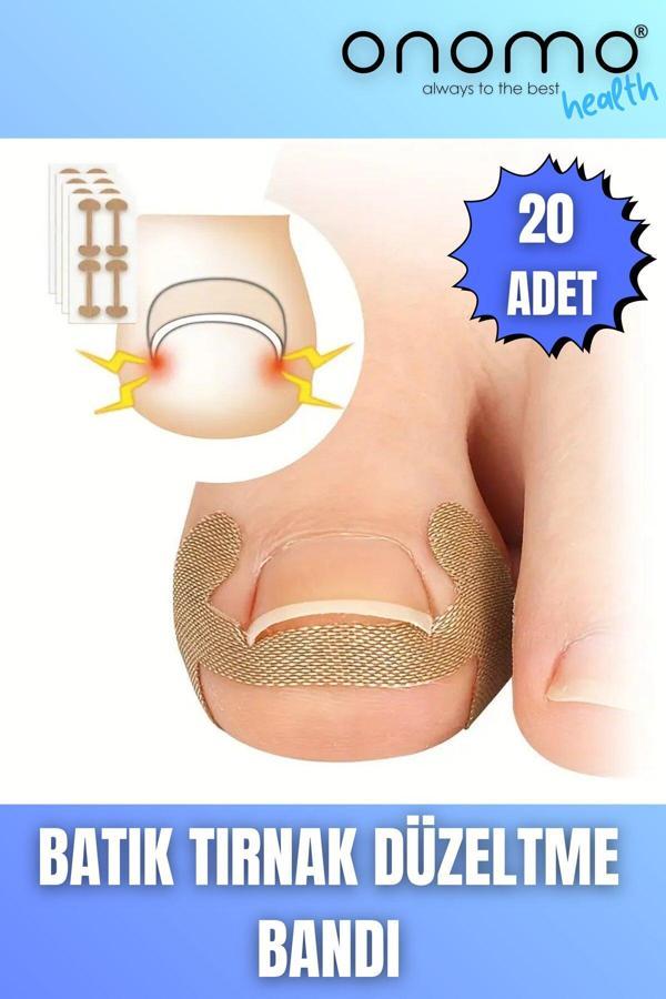 Onomo Health Batık Tırnak Düzeltme Bandı 20 Adet - Image 1