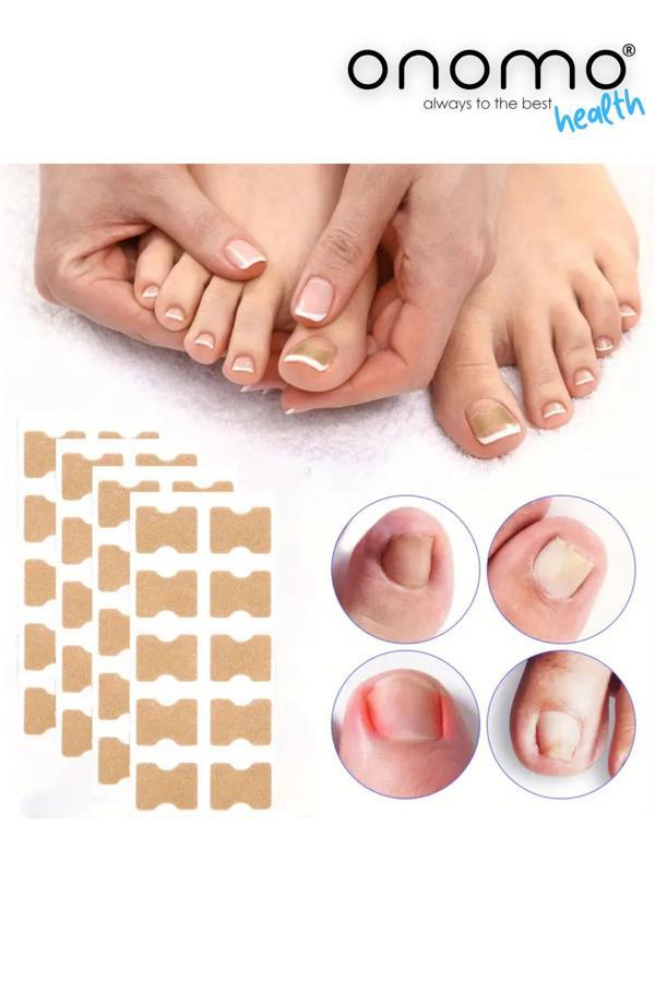 Onomo Health Ayak Batık Tırnak Düzeltme Bandı 50 Adet - Image 1