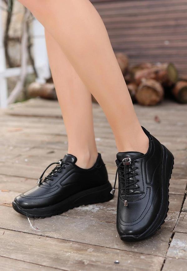 Romy Siyah Cilt  Bağcıklı Spor Ayakkabı - Image 1