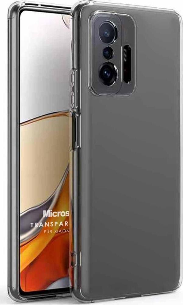 Microsonic Xiaomi Mi 11T Kılıf Transparent Soft Beyaz - Image 1