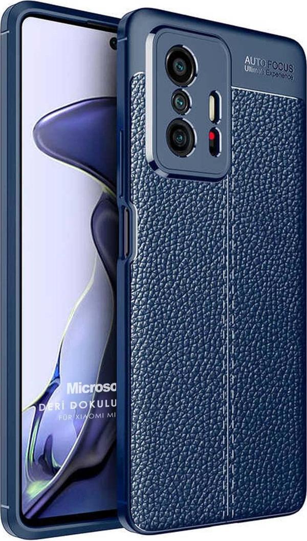 Microsonic Xiaomi Mi 11T Pro Kılıf Deri Dokulu Silikon Lacivert - Image 1