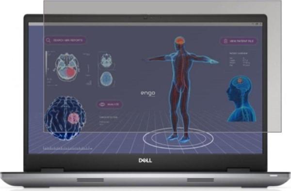 Dell Precision 7780 15.6 İnç Hayalet Ekran Koruyucu 16:9 - Image 1