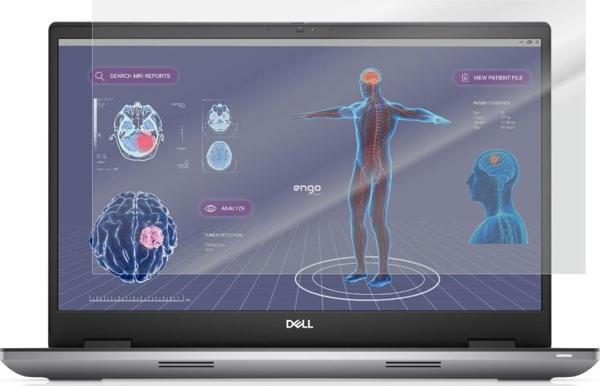 Dell Precision 7780 17.3 inç Mat Ekran Koruyucu Şeffaf - Image 1