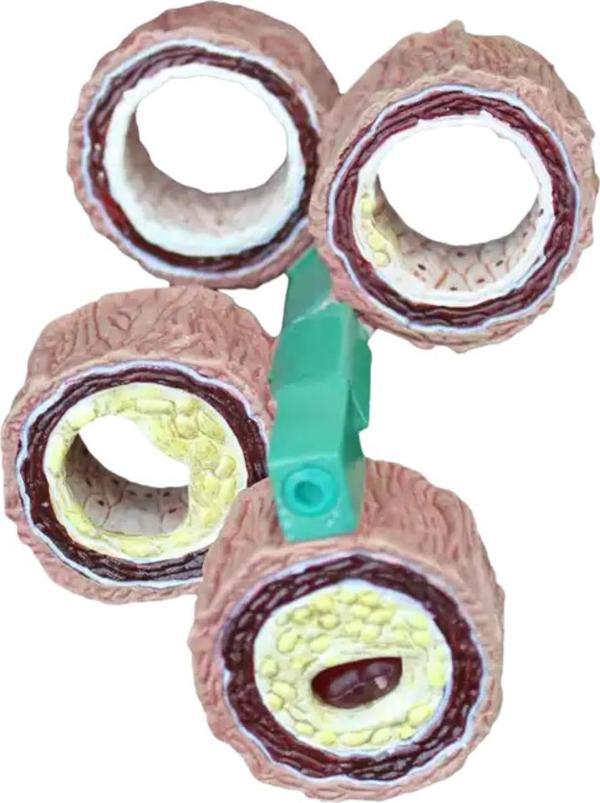 Damar Maketi Tıp Eğitim Maketi Model 45  - Image 1