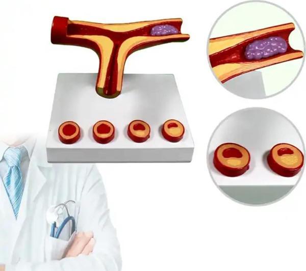 Damar Maketi Tıp Eğitim Maketi Model 46 - Image 1