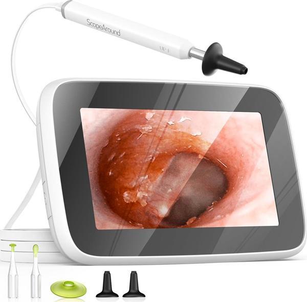 ScopeAround Dijital Otoskop Işıklı, Kulak Temizleme Kamerası - Image 1
