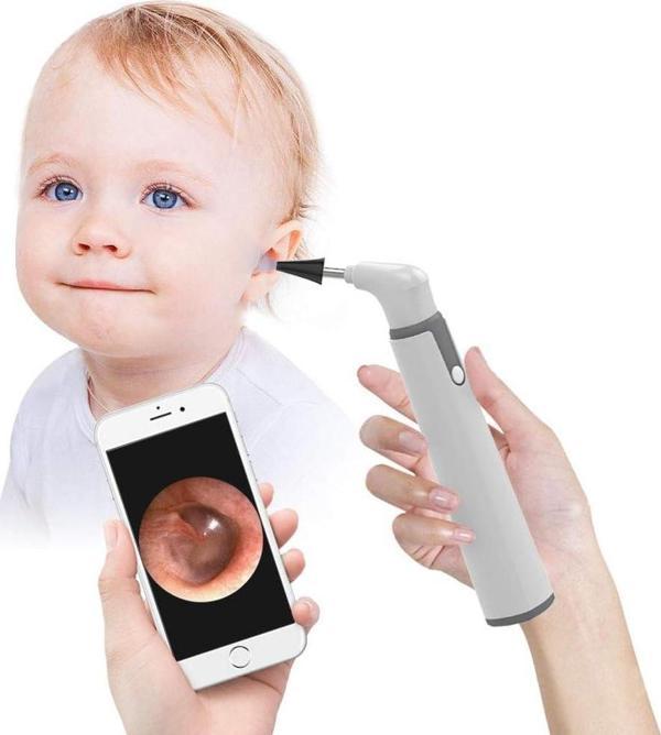 ScopeAround Kablosuz Otoskop, 3.9 mm Ultra İnce WiFi Kulak Kamerası - Image 1
