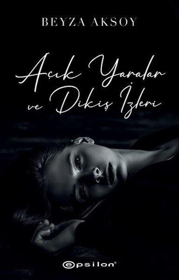 Açık Yaralar ve Dikiş İzleri - Epsilon Yayınevi - Image 1