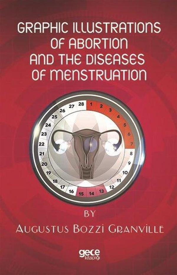 Graphic Illustrations of Abortion and the Diseases of Menstruation - Gece Kitaplığı - Image 1