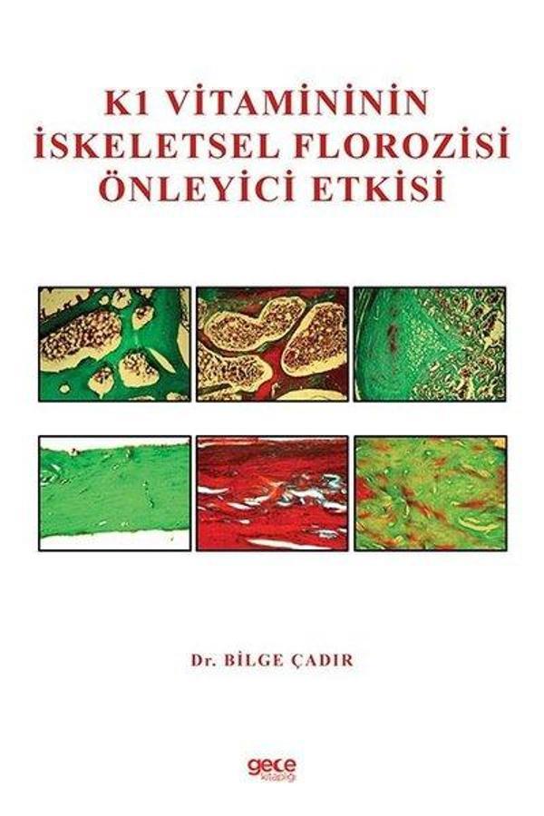 K1 Vitamininin İskeletsel Florozisi Önleyici Etkisi - Gece Kitaplığı - Image 1