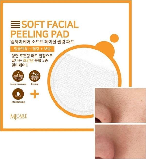 MjCare Face Peeling - Yüz Peeling Pad - Image 1