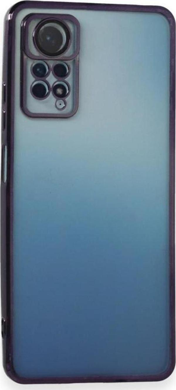 Xiaomi Redmi Note 11 / 11s Kılıf Razer Lens Çerçeveli Silikon Kapak - Image 1