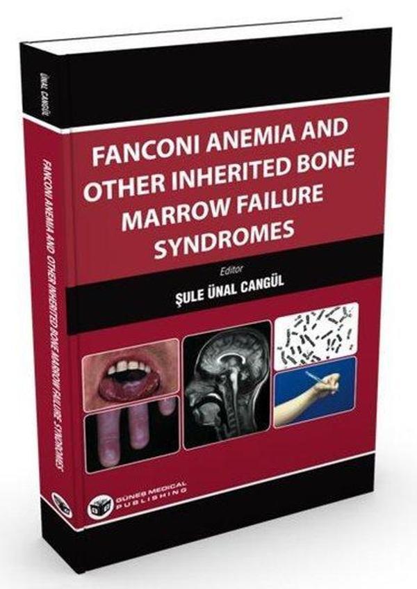 Fanconi Anemia and Other Inherited Bone Marrow Failure Syndromes - Güneş Tıp Kitabevleri - Image 1