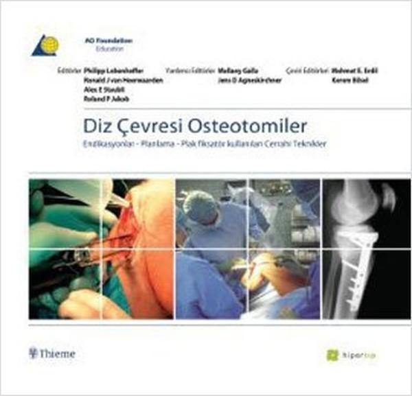 Diz Çevresi Osteotomiler - Hiperlink - Image 1
