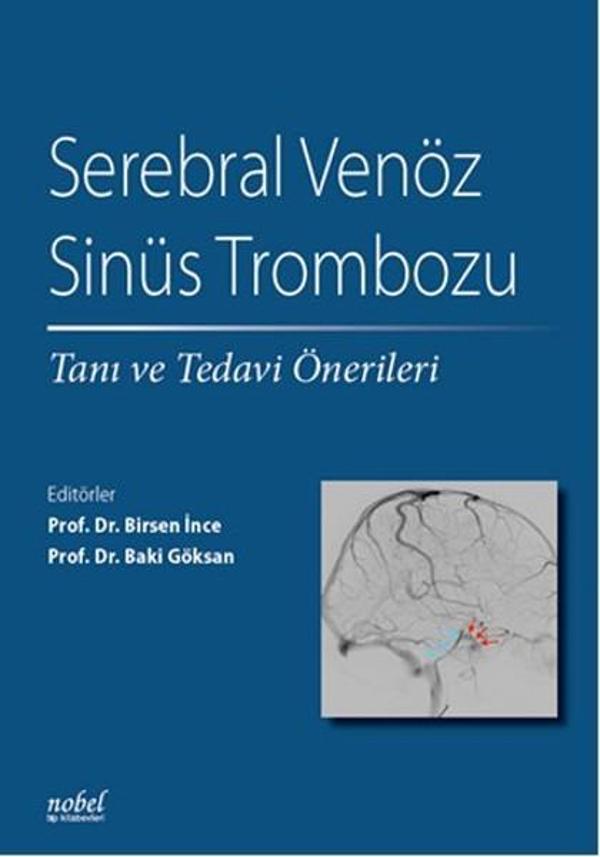 Serebral Venöz Sinüs Trombozu Tanı ve Tedavi Önerileri - Nobel Tıp Kitabevleri - Image 1