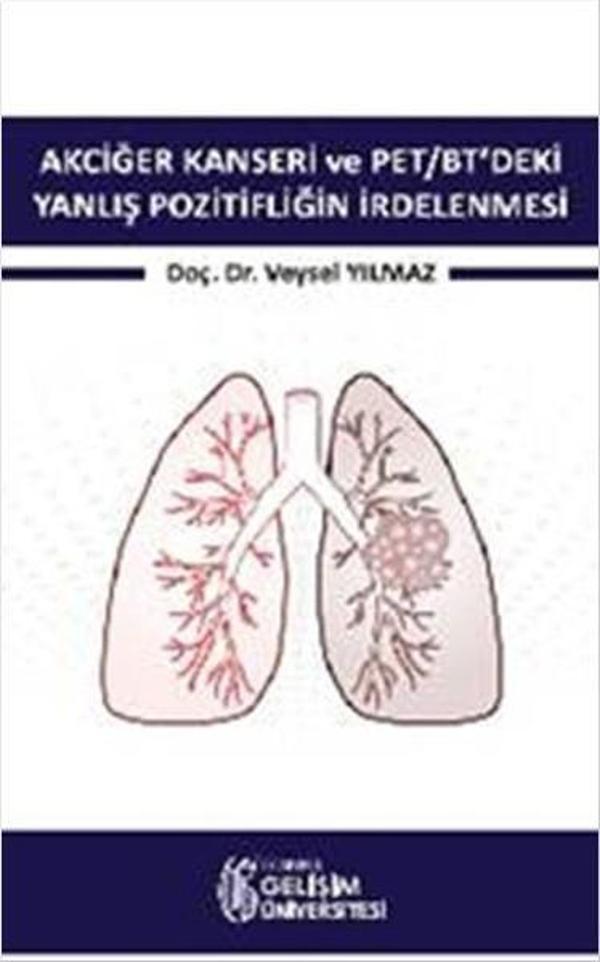 Akciğer Kanseri ve PET-BT'deki Yanlış Pozitifliğin İrdelenmesi - İstanbul Gelişim Üniversitesi - Image 1