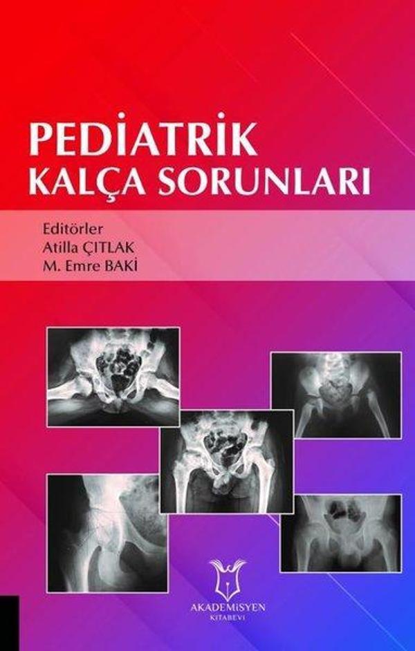 Pediatrik Kalça Sorunları - Akademisyen Kitabevi - Image 1