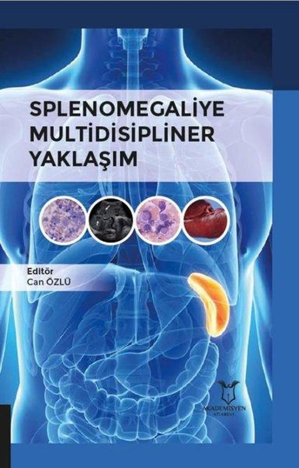 Splenomegaliye Multidisipliner Yaklaşım - Akademisyen Kitabevi - Image 1