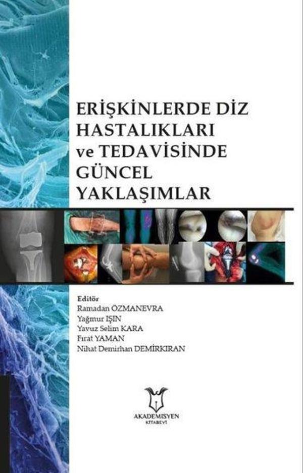 Erişkinlerde Diz Hastalıkları ve Teavisinde Güncel Yaklaşımlar - Akademisyen Kitabevi - Image 1