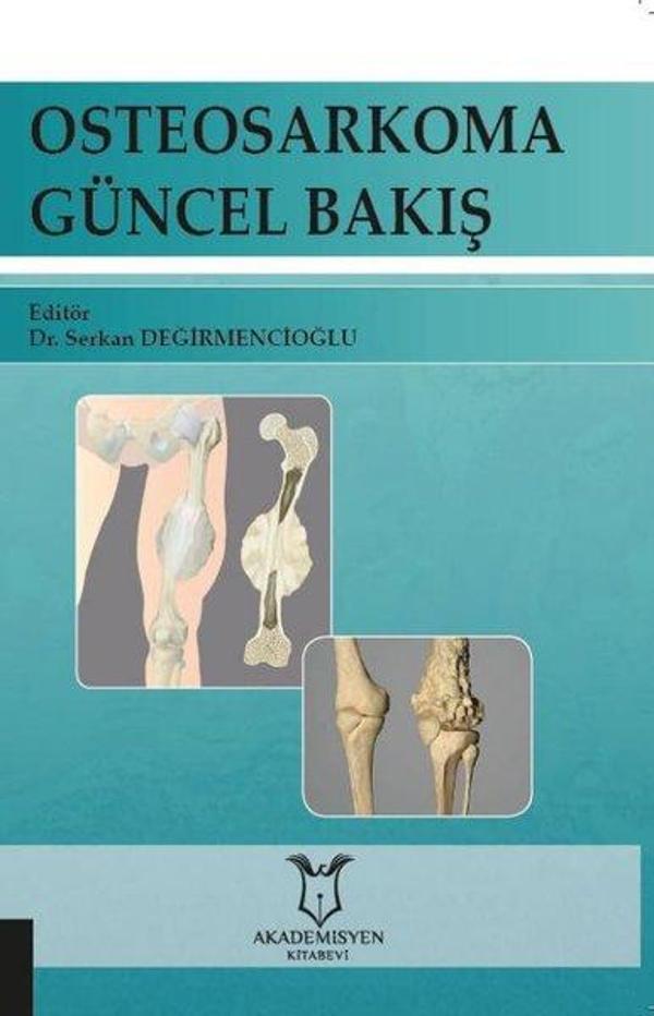 Osteosarkoma Güncel Bakış - Akademisyen Kitabevi - Image 1