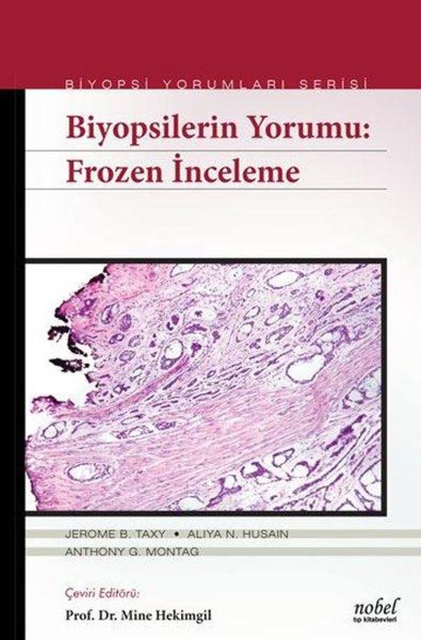 Biyopsilerin Yorumu: Frozen İnceleme - Nobel Tıp Kitabevleri - Image 1