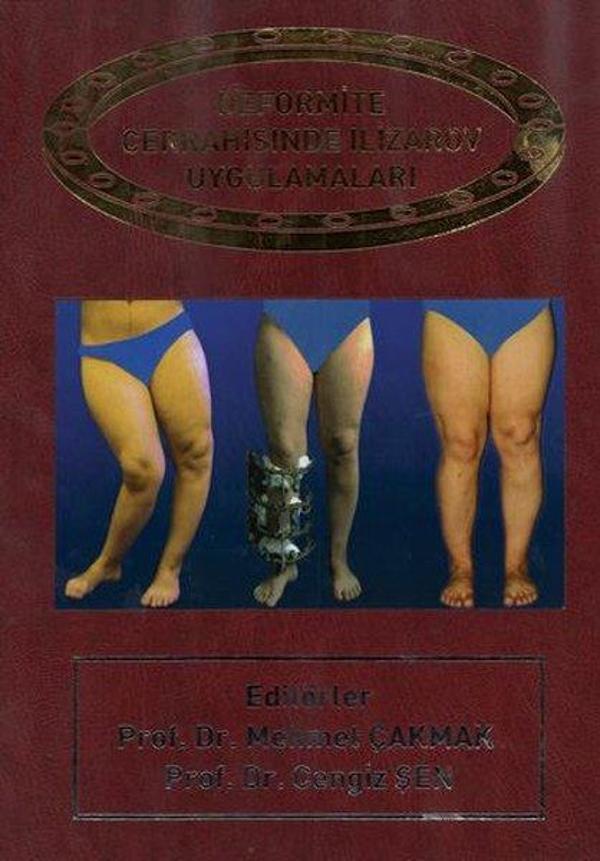 Deformite Cerrahisinde İlizarov Cerrahisi - Nobel Tıp Kitabevleri - Image 1