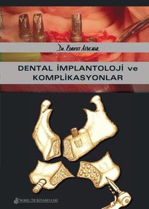Dental İmplantoloji ve Komplikasyonlar - Nobel Tıp Kitabevleri - Image 1
