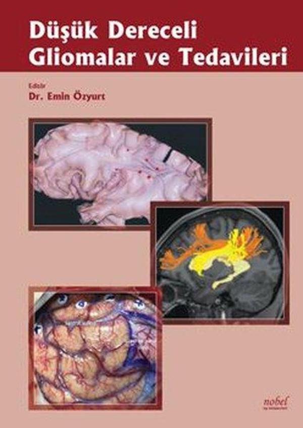 Düşük Dereceli Gliomalar Ve Tedavileri - Nobel Tıp Kitabevleri - Image 1