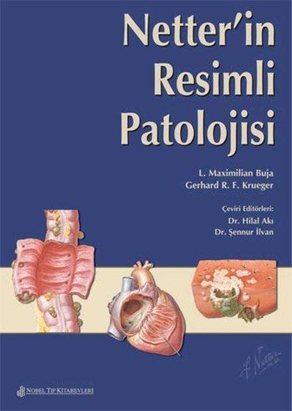 Netter'İn Resimli Patolojisi - Nobel Tıp Kitabevleri - Image 1