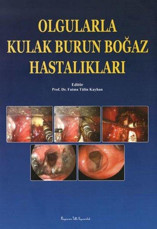 Olgularla Kulak Burun Boğaz Hastalıkları - Nobel Tıp Kitabevleri - Image 1