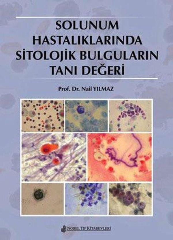 Solunum Hastalıklarında Sitolojik Bulguların Tanı Değeri - Nobel Tıp Kitabevleri - Image 1