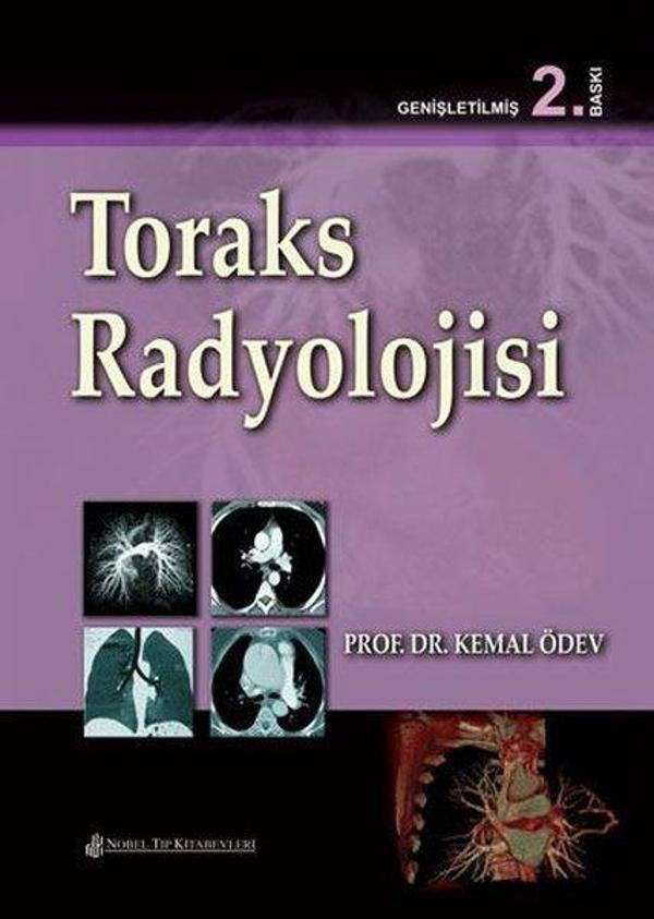 Toraks Radyolojisi - Nobel Tıp Kitabevleri - Image 1