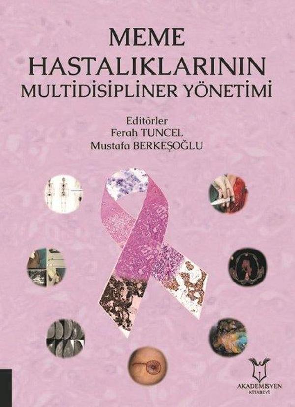Meme Hastalıklarının Multidisipliner Yönetimi - Akademisyen Kitabevi - Image 1