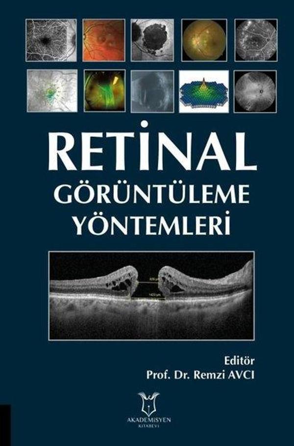 Retinal Görüntüleme Yöntemleri - Akademisyen Kitabevi - Image 1