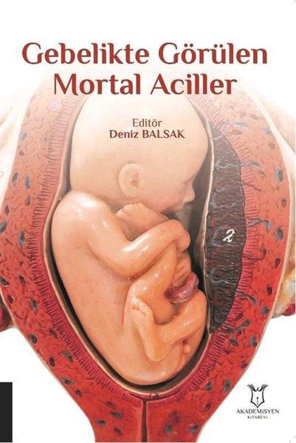 Gebelikte Görülen Mortal Aciller - Akademisyen Kitabevi - Image 1