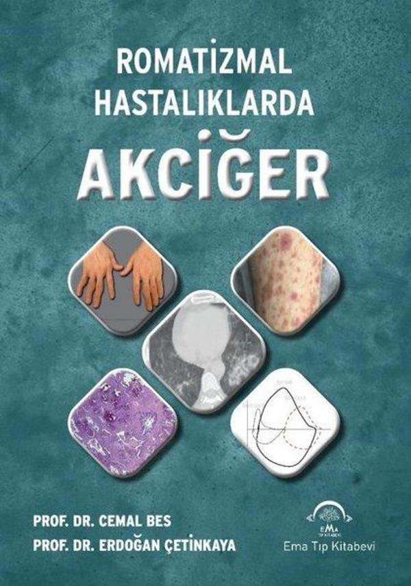 Romatizmal Hastalıklarda Akciğer - Ema Tıp Kitabevi - Image 1