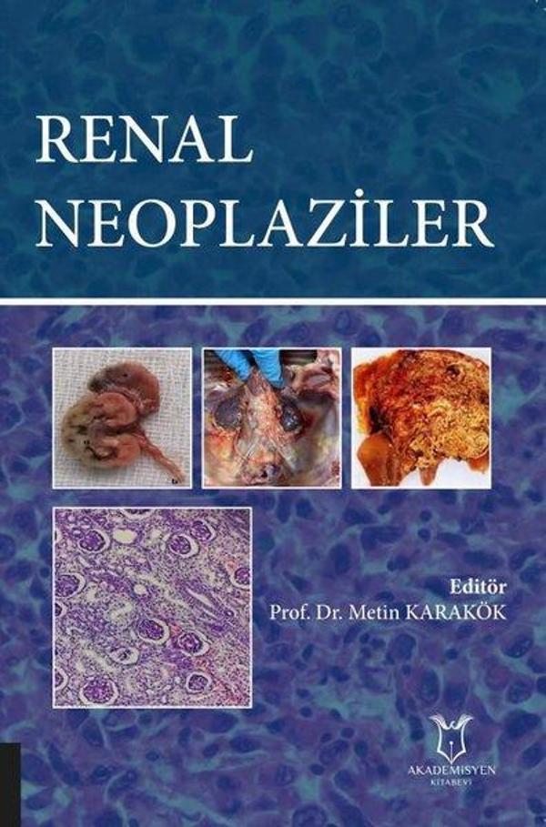 Renal Neoplaziler - Akademisyen Kitabevi - Image 1