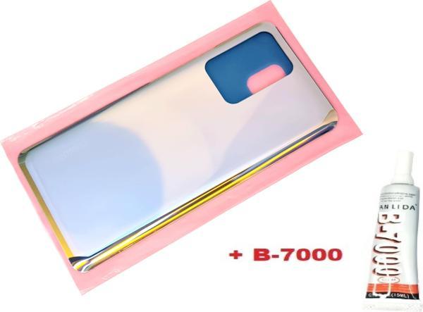 Tkgz Xiaomi Mi 11T Arka Pil Batarya Kapağı (CAM+B-7000) GOLD - Image 1