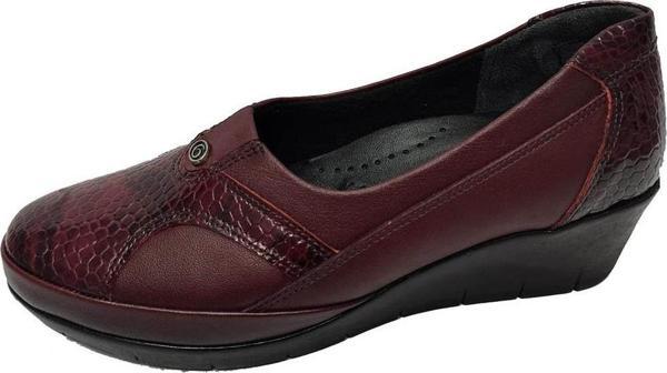 Scavia 105-20 Hakiki Rugan Ortopedik Kadın Ayakkabı - Image 1