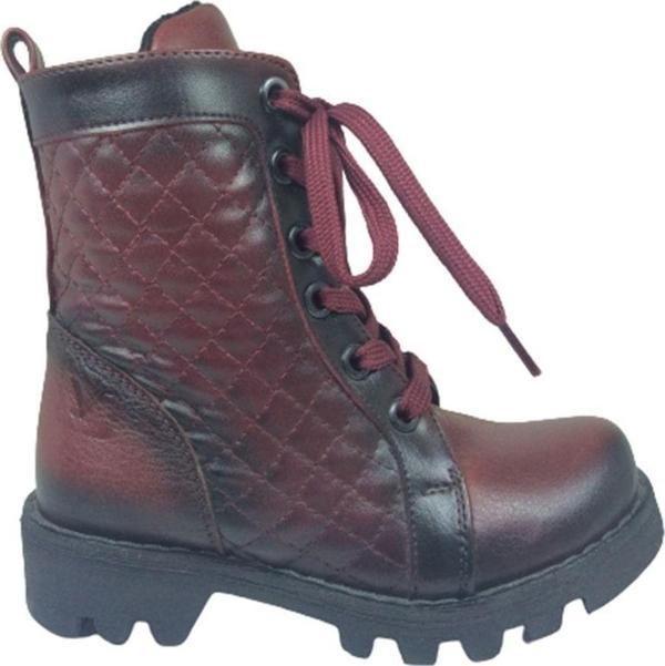 Bordo Ortopedika Lolita Patik Kız Çocuk Bot Yanı Fermuarlı - Image 1