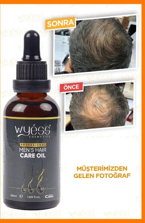 Wyess Erkek Saç Bakım Yağı-Serumu Dökülme Karşıtı, Yeni Saç Teli Çıkaran, E / A Vitaminli 35 Yağ 50 Ml - Image 1