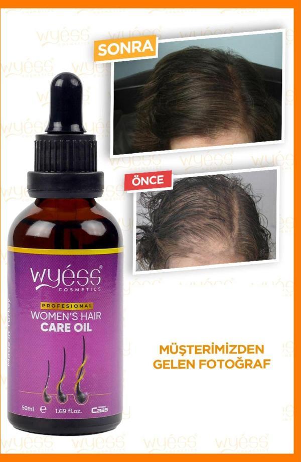Wyess Kadın Saç Bakım Yağı-Serumu Dökülme Karşıtı, Yeni Saç Teli Çıkaran, Kenevir Yağı 35 Yağ 50 Ml - Image 1