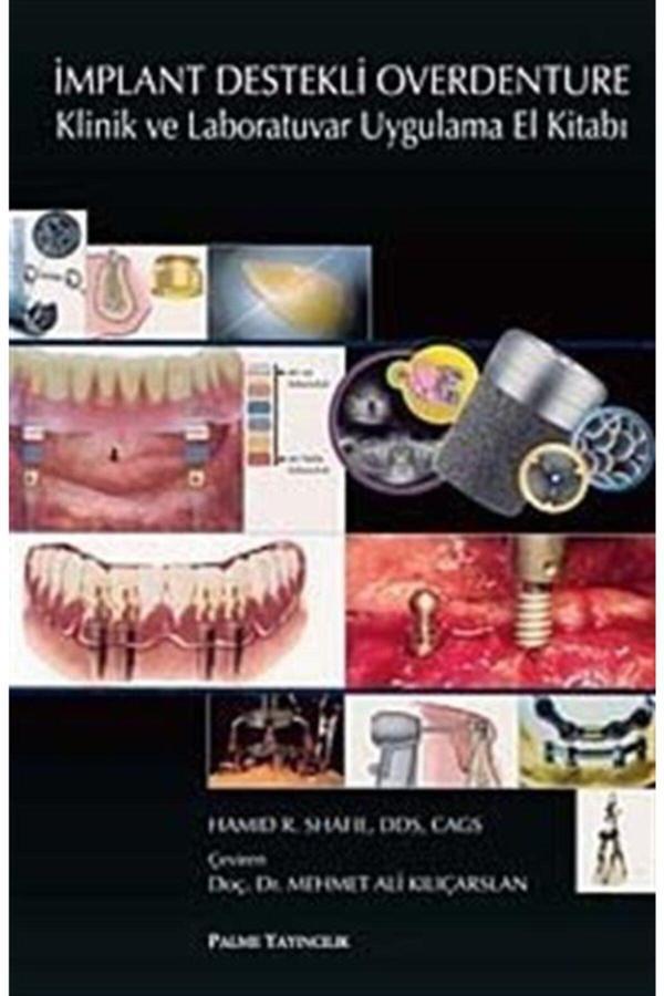 Implant Destekli Overdenture & Klinik Ve Laboratuvar Uygulama El Kitabı - Palme Yayınları - Palme Yayınları - Image 1