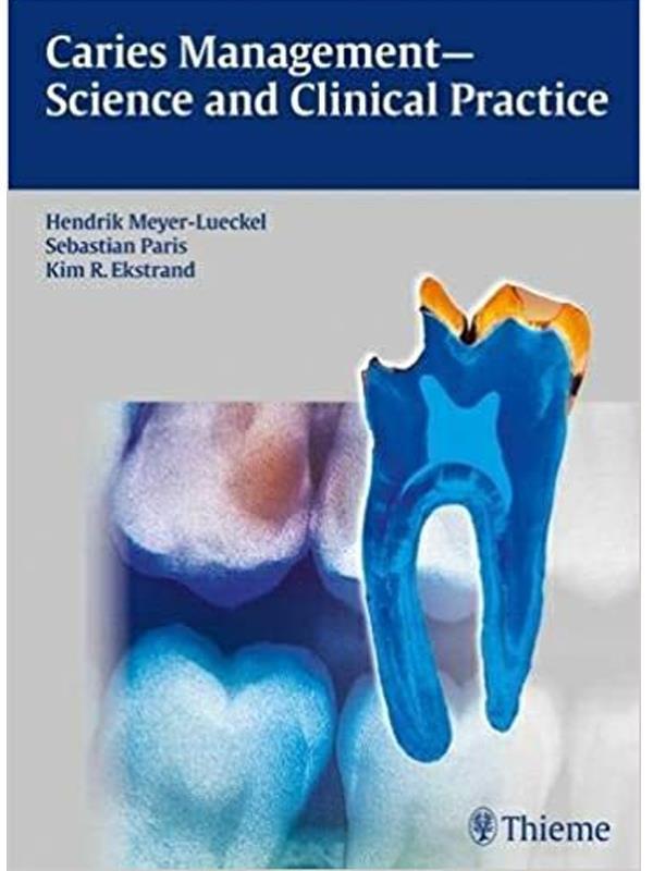 Carıes Management Scıence And Clınıcal Practıce - Thieme - Thieme - Image 1