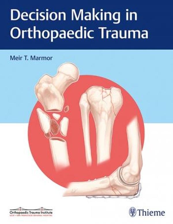 Decısıon Makıng In Orthopaedıc Trauma - Thieme - Thieme - Image 1