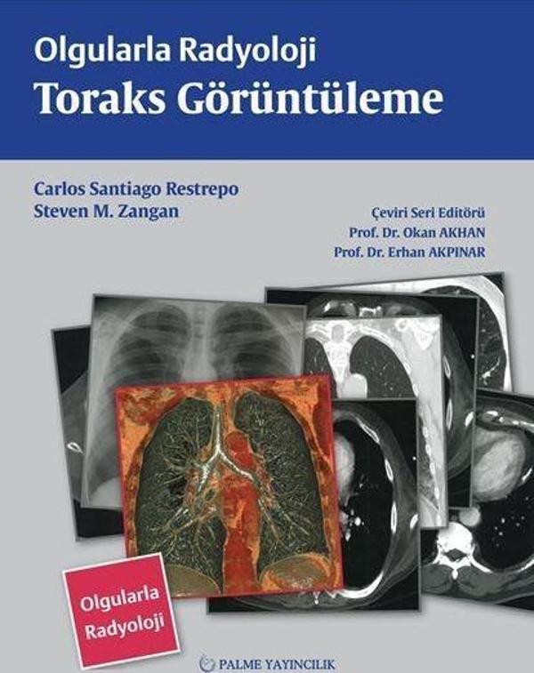 Olgularla Radyoloji Toraks Görüntüleme - Palme Yayınları - Image 1